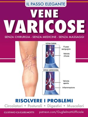 cover image of Vene varicose--Prevenire, ridurre ed eliminare